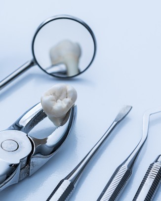 Keeping Extracted Teeth at the Dentist