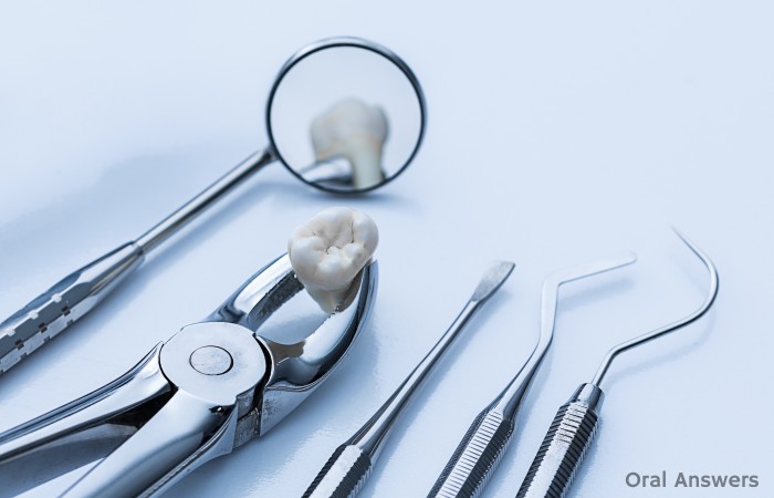 Keeping Extracted Teeth at the Dentist