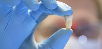 What Happens to Extracted Teeth?
